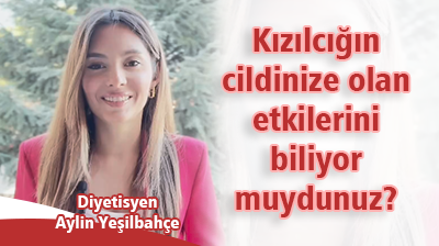 Kızılcığın cildinize olan etkilerini biliyor muydunuz?